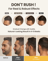 10PCS Gray White Hair Treatment Serum Liquid White To Black Natural Color Repair Nourish Product Anti Loss Hair Care Men Women