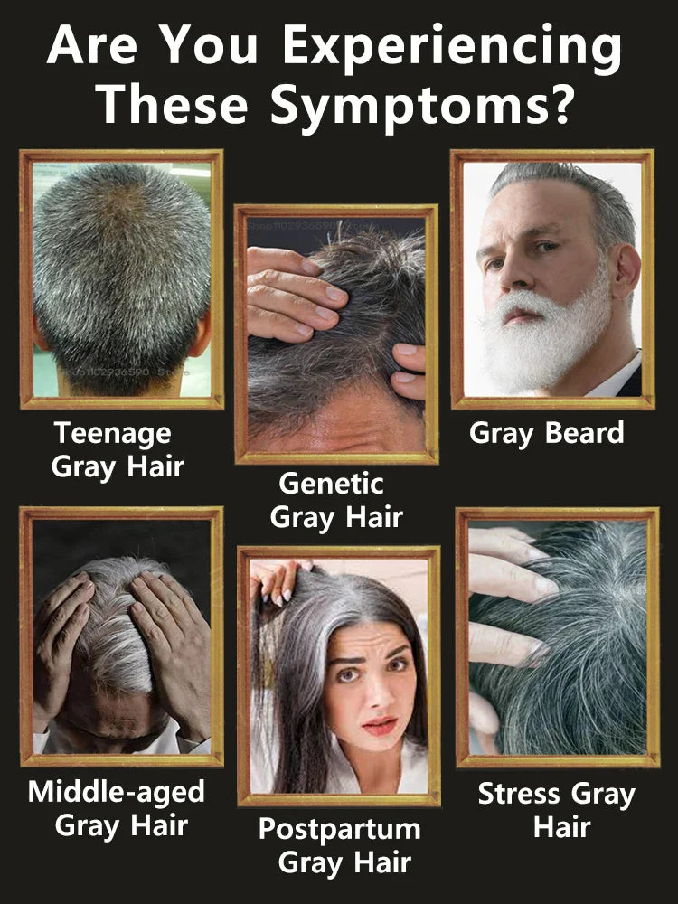 10PCS Gray White Hair Treatment Serum Liquid White To Black Natural Color Repair Nourish Product Anti Loss Hair Care Men Women