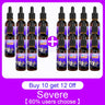 10PCS Gray White Hair Treatment Serum Liquid White To Black Natural Color Repair Nourish Product Anti Loss Hair Care Men Women