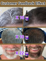 10PCS Gray White Hair Treatment Serum Liquid White To Black Natural Color Repair Nourish Product Anti Loss Hair Care Men Women
