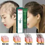 2023 Biotin Fast Hair Growth Oil Hair Regrowth Serum Hair Thinning Treatment Hair Growth Liquid Anti-Hair Loss for Women amp Men