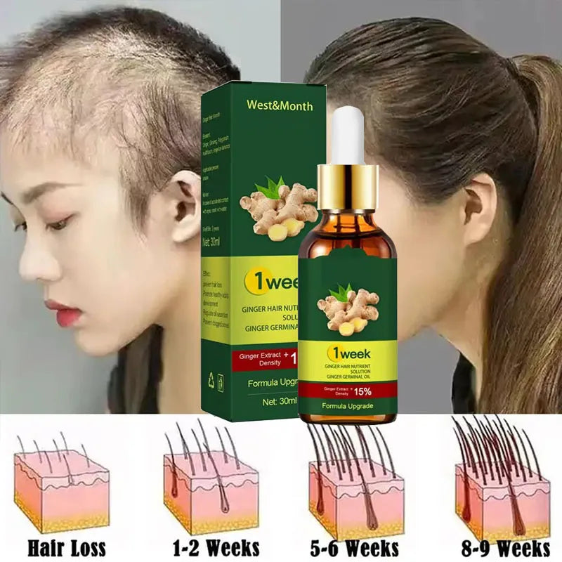 7 Days Ginger Hair Growth Products Fast Promote Hair Regrowth Serum Anti Hair Loss Scalp Treatment Baldness Care Essential Oils