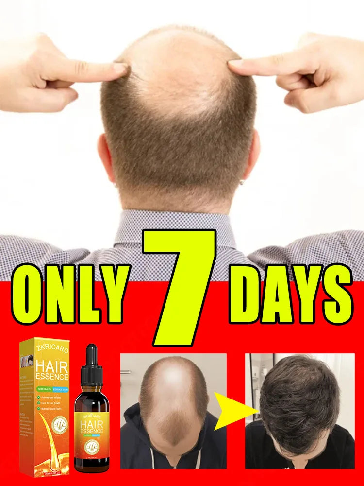 Anti Alopecia Fast Hair Growth Oil Ginger Essential Serum