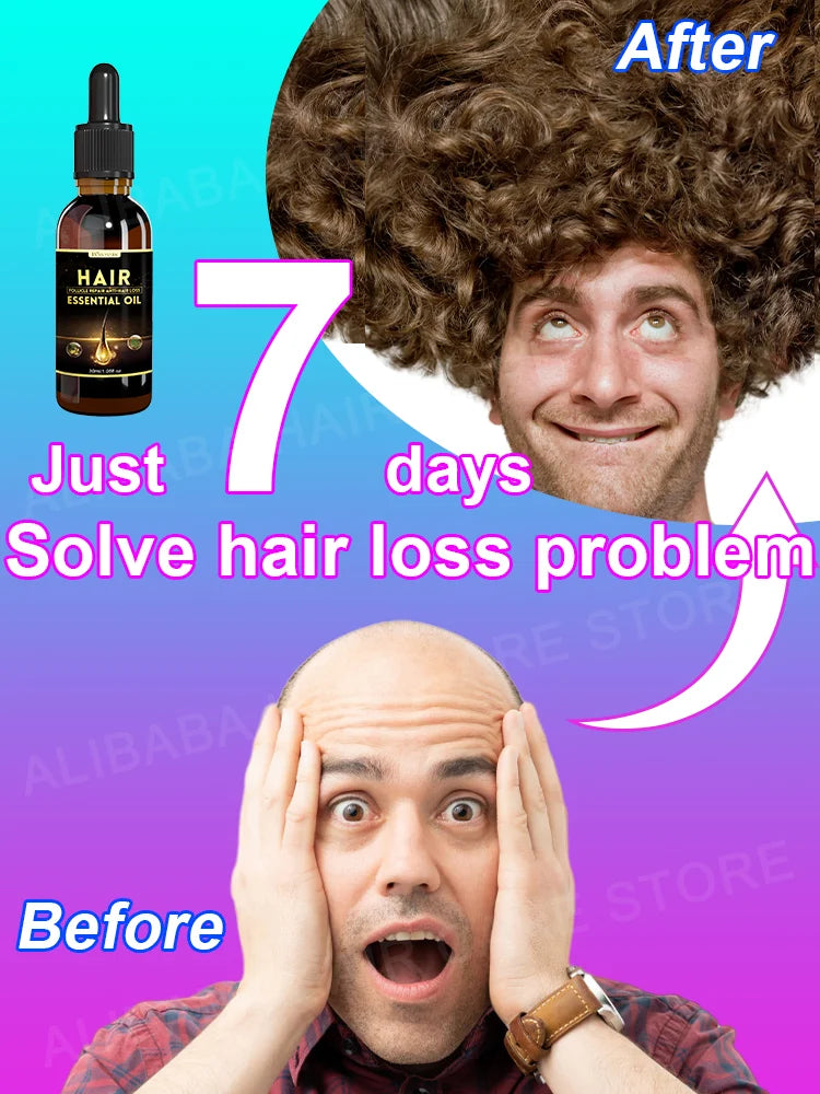 Best-selling Hair Growth Products, Anti-Hair Loss Hair Growth Serum for Men and Women, Fast Hair Growth Oil, 100% Natural