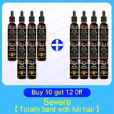 Best-selling Hair Growth Products, Anti-Hair Loss Hair Growth Serum for Men and Women, Fast Hair Growth Oil, 100% Natural