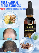 Best-selling Hair Growth Products, Anti-Hair Loss Hair Growth Serum for Men and Women, Fast Hair Growth Oil, 100% Natural