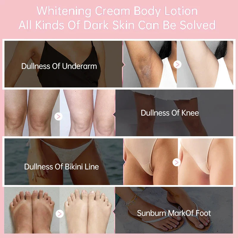 Body Whitening Cream Arms Thighs Underarm Knees Whitening Essence Cream Brighten Moisturizing Body Korean Skin Care Products 30g