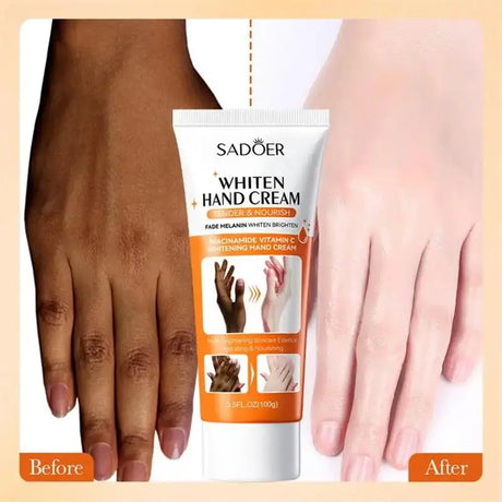 Body Whitening Cream Intimate Area Whitening Cream Pink Body Lotion Lighten Melanin Underarms Knee Joint Bright Body Care 60ml