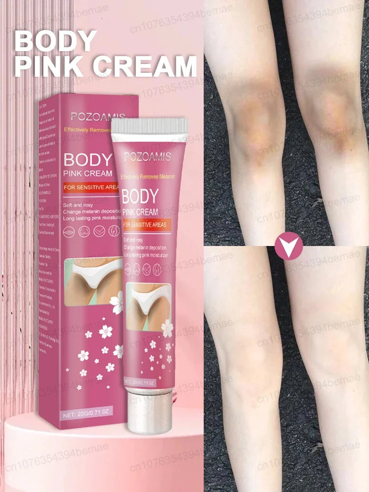 Body Whitening Cream Skin Pink Treatment Keratosis Pilaris lotion Melanin Removal Moisture Private Parts Care Safe For Women Men