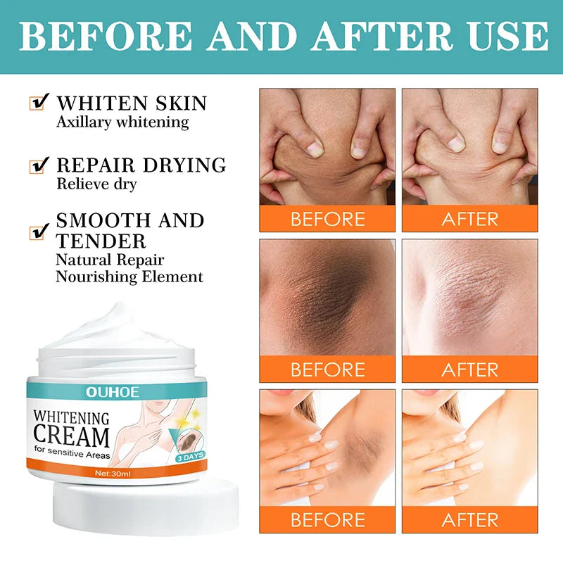 Body Whitening Cream Women Underarm Legs Knee Elbow Private Parts Brighten Armpit Whitening Cream Remove Dark Spots Skin Care