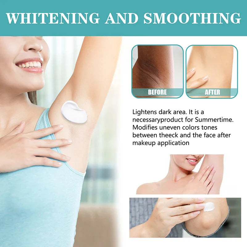 Body Whitening Cream Women Underarm Legs Knee Elbow Private Parts Brighten Armpit Whitening Cream Remove Dark Spots Skin Care