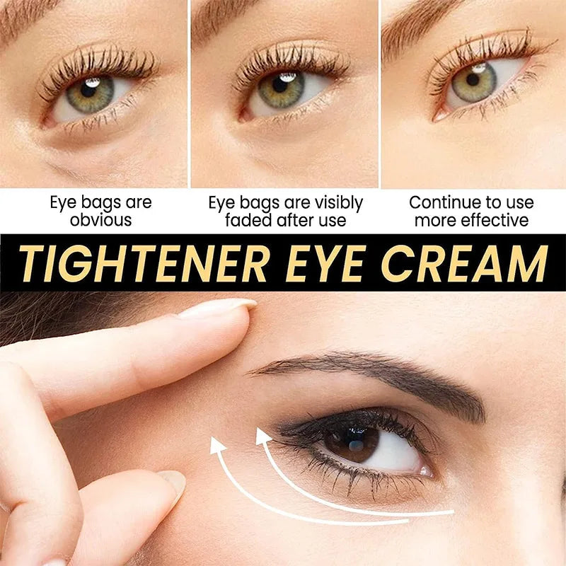 Eyes Cream CËLYN Lifting Firming Eye Skin Hyaluronic Acid Reduce Wrinkles Removal Eye Bag Dark Circles Eye Skin Care Product