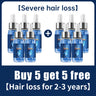 Fast Hair Growth Essence Oil Products Effective Baldness Repair Treatment Anti Hereditary Seborrheic Alopecia Loss For Men Women