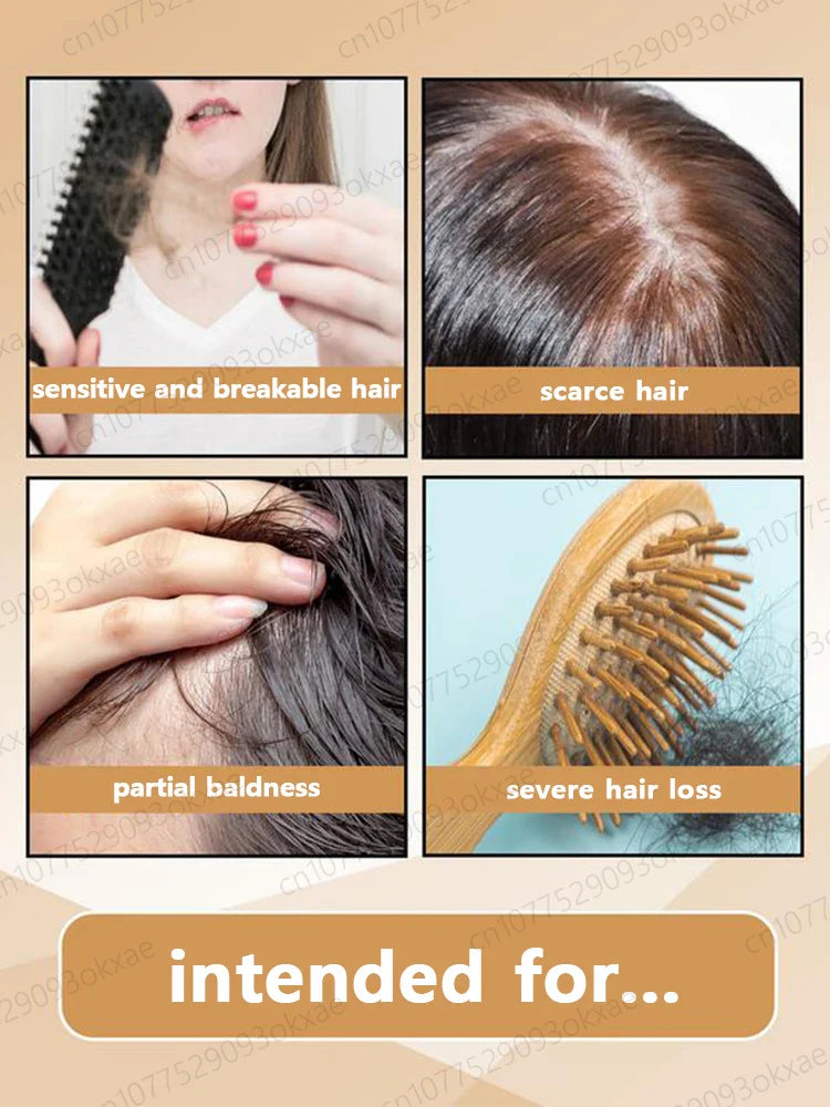 Fast Hair Growth Essence Oil Products Effective Baldness Repair Treatment Anti Hereditary Seborrheic Alopecia Loss For Men Women