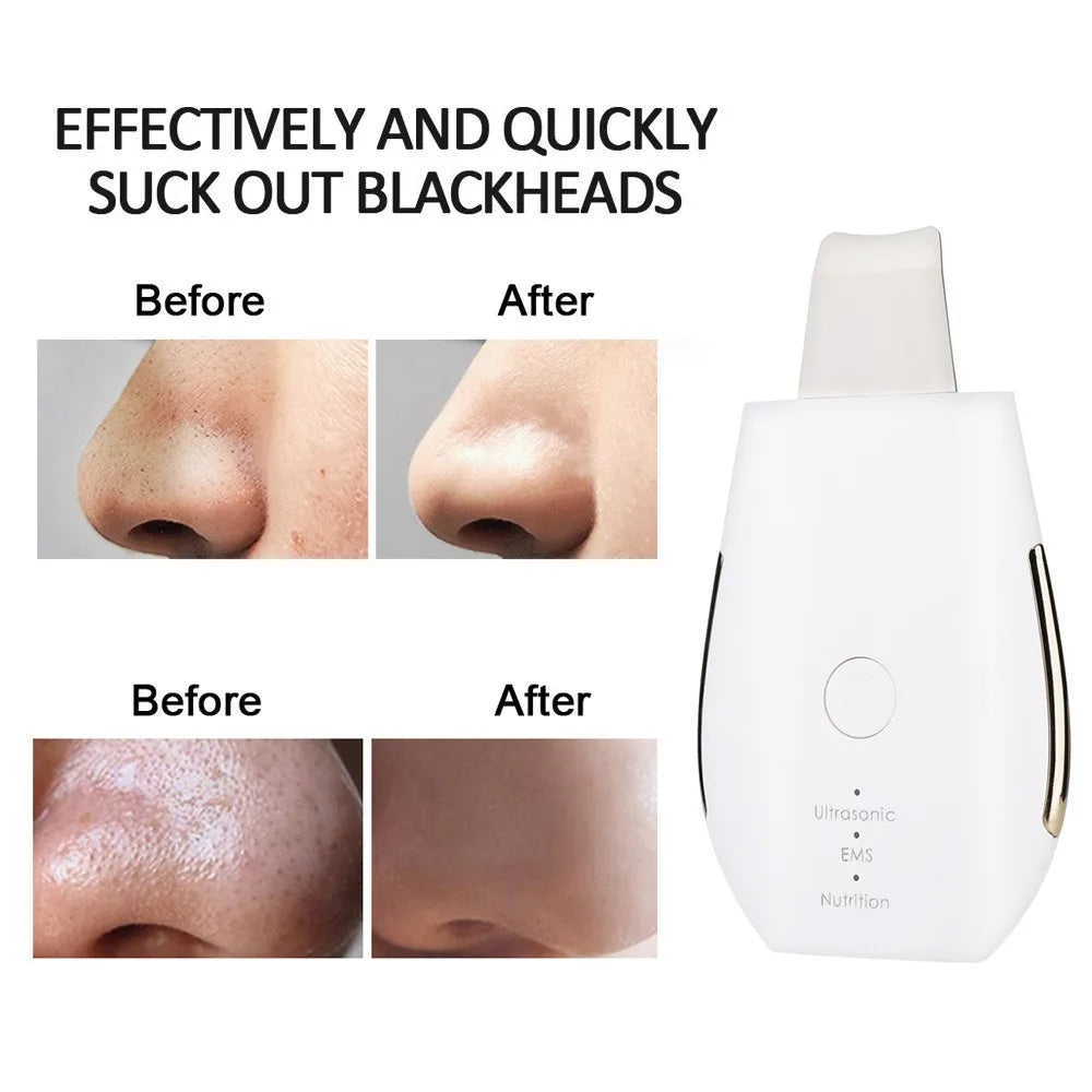 Rechargeable Ultrasonic Face Skin Scrubber Facial Cleaner Peeling Vibration Blackhead Removal Exfoliating Pore Cleaner Tools