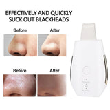 Rechargeable Ultrasonic Face Skin Scrubber Facial Cleaner Peeling Vibration Blackhead Removal Exfoliating Pore Cleaner Tools