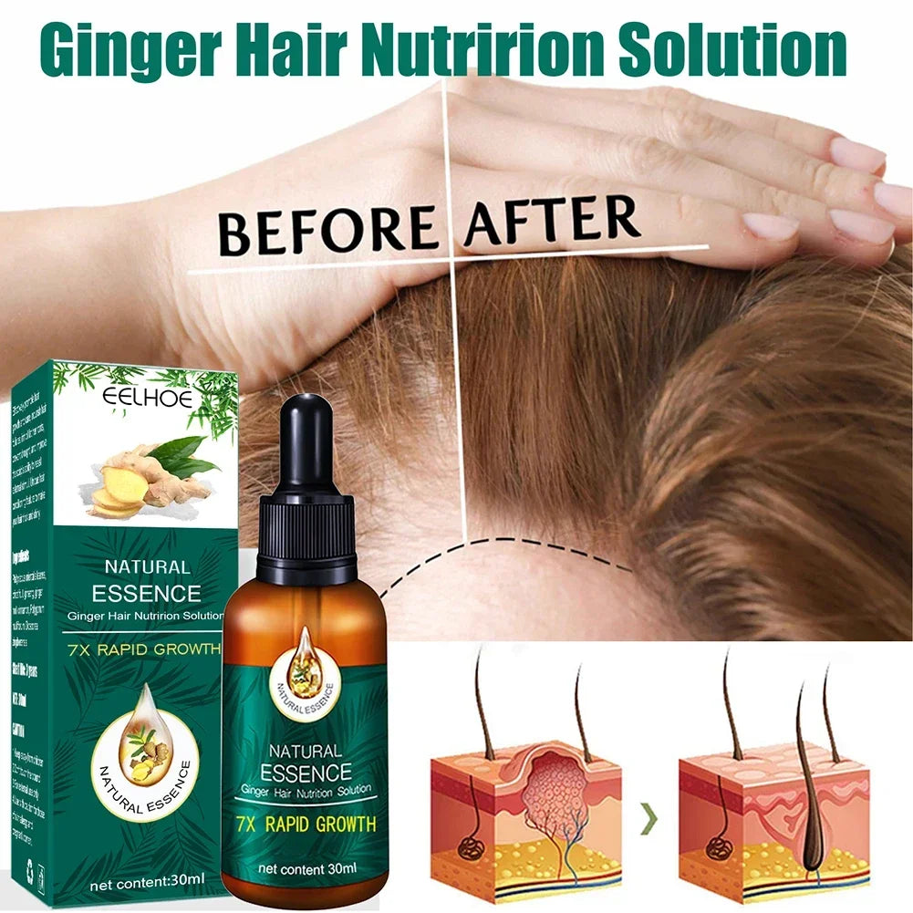 Hair Fast Growth And Care Essential Oil Natural Ginger Hair Regrowth Products Serum Hair Care Loss Series