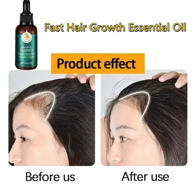 Hair Fast Growth And Care Essential Oil Natural Ginger Hair Regrowth Products Serum Hair Care Loss Series