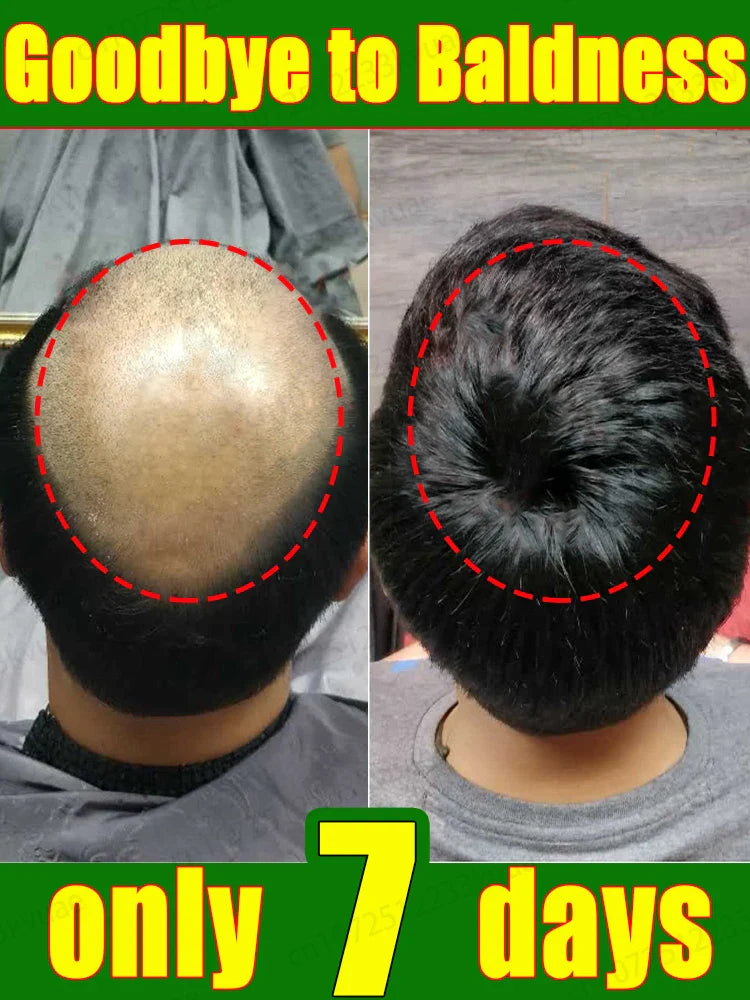 Hair growth essential oil. Effectively repair baldness and hair loss symptoms