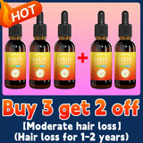 Hair growth essential oil. Effectively repair baldness and hair loss symptoms