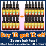 Hair growth essential oil. Effectively repair baldness and hair loss symptoms