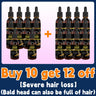 Hair growth oil,effective baldness repair, hereditary hair loss, postpartum hair loss