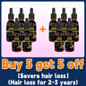 Hair growth oil,effective baldness repair, hereditary hair loss, postpartum hair loss