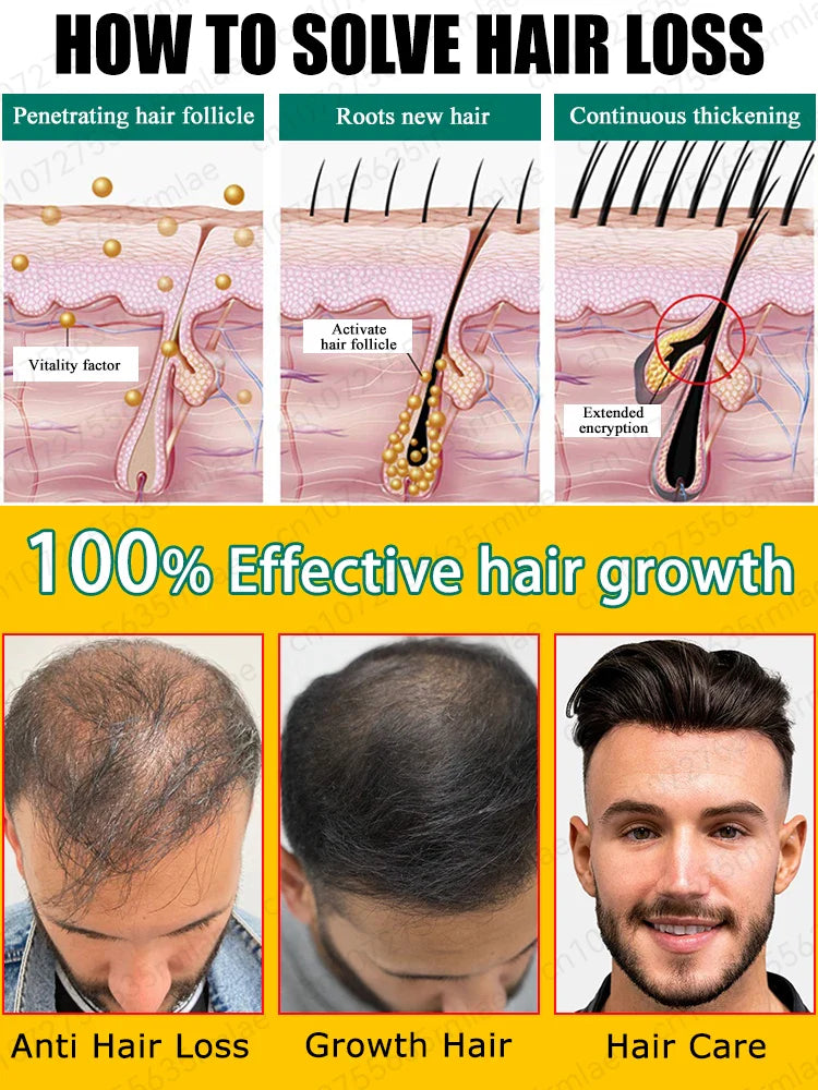 Hair growth oil,effective baldness repair, hereditary hair loss, postpartum hair loss