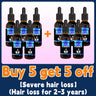 Hair growth oil, rapid hair growth, effective repair of baldness, repair of hair follicles