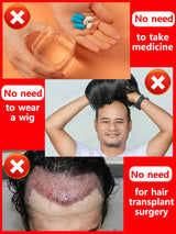 Hair growth oil, rapid hair growth, effective repair of baldness, repair of hair follicles