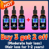 Hair growth oil, rapid hair growth, effective repair of baldness, repair of hair follicles