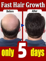 Hair growth products Fast Hair Growth Hair Growth Oil Effective Baldness Repair Hereditary Hair Loss Seborrheic Hair Anti Loss