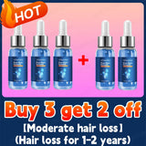 Hair growth products Fast Hair Growth Hair Growth Oil Effective Baldness Repair Hereditary Hair Loss Seborrheic Hair Anti Loss