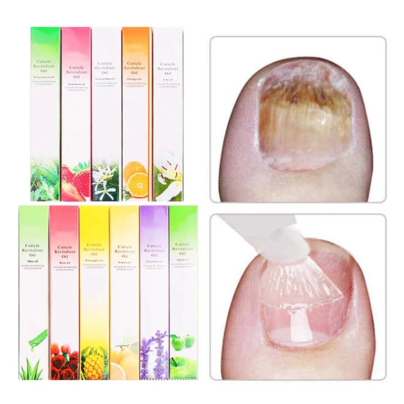 15 Smells Nail Nutrition Oil Pen Nail Treatment Cuticle Revitalizer Oil Prevent Agnail Nail Polish Nourish Skin Nail Treatment