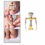 Ingrown Nail Recover Pedicure Tool Fixer Nail Curly Embed Corrector Orthotic Kit Personal Health Care Accessories