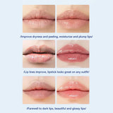 Hyaluronic Lip Balm Acid Remove Dark Whitening Moisturizing Cream Exfoliating Dead Skin Lightening Pigment Lip Care Health