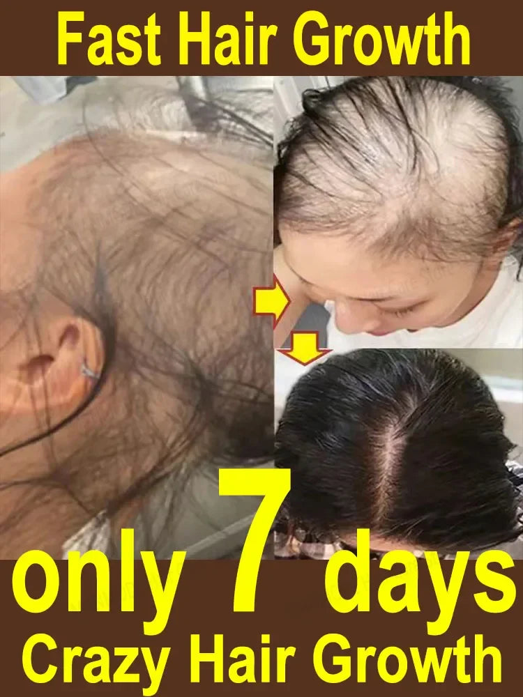 Instant Hair Growth Oil Restorer  Bald Patch Repair Fast Growing Essential Oil Prevent Loss Nourish Hair Products Conditioner