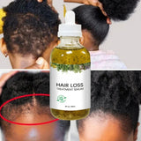 New Fast Hair Growth Serum 100% African Crazy Traction Alopecia Anti Hair Loss Essential Prevents Bald Thinnin Hair Care Oil