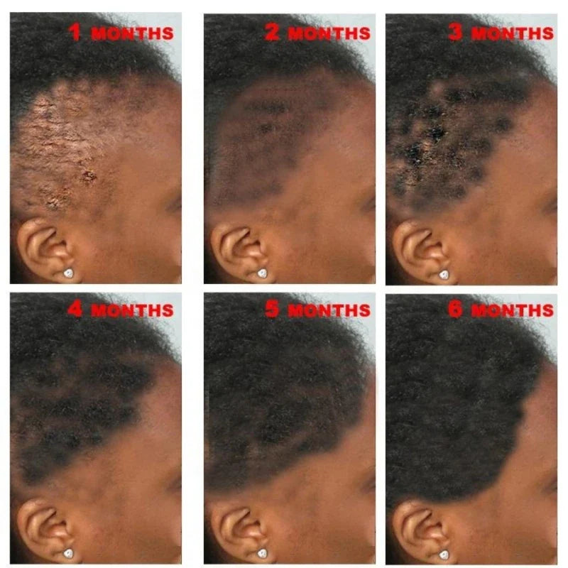 New Fast Hair Growth Serum 100% African Crazy Traction Alopecia Anti Hair Loss Essential Prevents Bald Thinnin Hair Care Oil