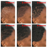 New Fast Hair Growth Serum 100% African Crazy Traction Alopecia Anti Hair Loss Essential Prevents Bald Thinnin Hair Care Oil