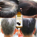 New Repair Damage Anti-Hair Sercum Gray Hair Care Serum Ebony Hair Nourishing Hair Loss Men And Women Fast Lasting Beauty Health