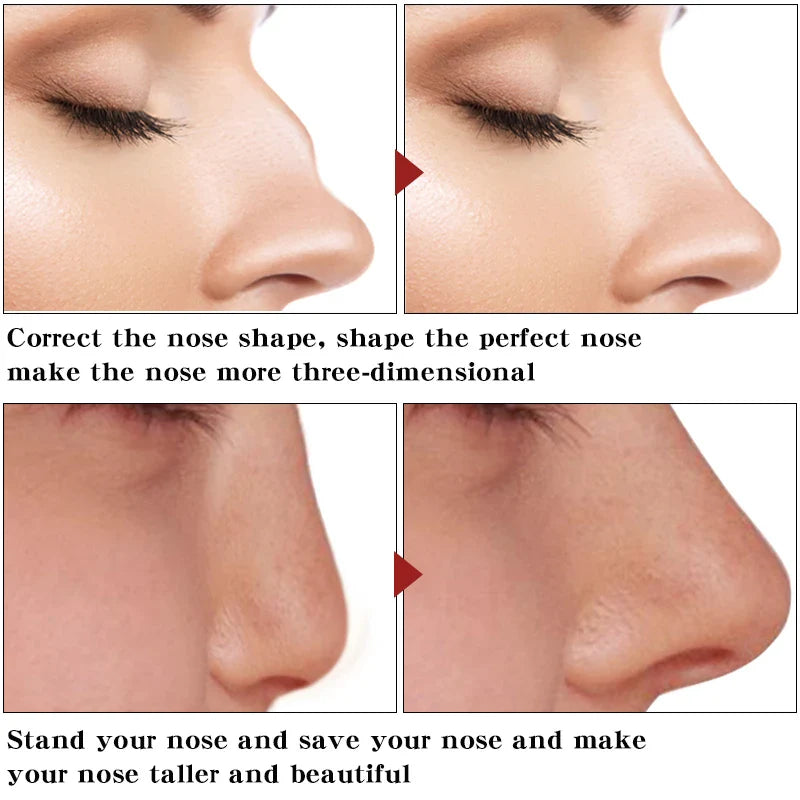 Nose Up Heighten Rhinoplasty Oil 30ml Nose Up Heighten Rhinoplasty Nasal Bone Remodeling Pure Natural Care Thin Smaller Nose