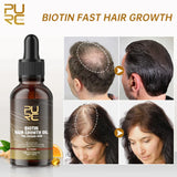 PURC Fast Hair Growth Products for Men Biotin Anti Hair Loss Oil Shampoo Conditioner Set Hair Treatment for Women Beauty Health