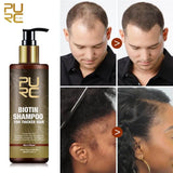 PURC Fast Hair Growth Products for Men Biotin Anti Hair Loss Oil Shampoo Conditioner Set Hair Treatment for Women Beauty Health