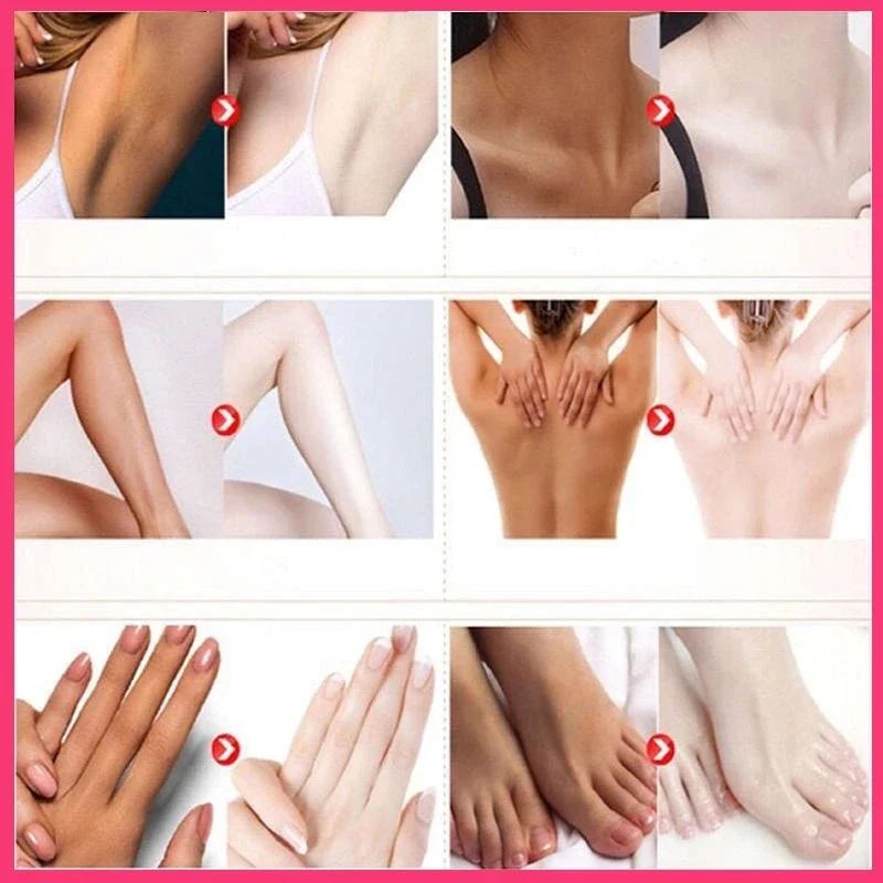 Private body whitening cream armpit buttock nipple private area pink essence to remove melanin brighten beauty care Melanin remo