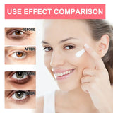 Retinol Anti-Wrinkle Eye Cream Remove Eye Bags Dark Circles Anti Aging Lifting Firming Whitening Moisturizing Brighten Skin Care