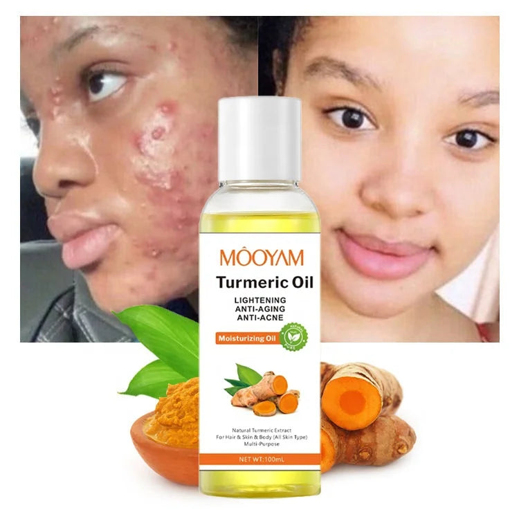 Turmeric Oil Face Whitening Lightening Acne Dark Patches Anti-aging Dark Spot Corrector Skin Care Turmeric Oil for Dark Skin