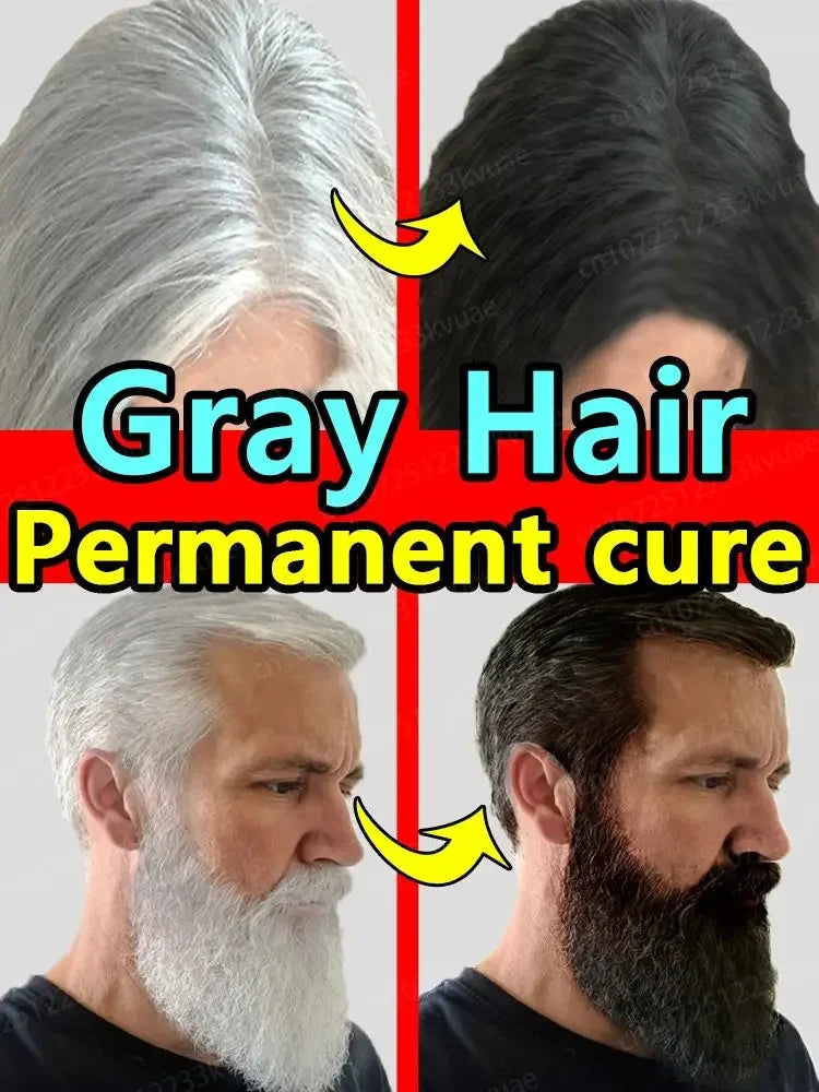 Gray Hair Killer - Seven Days to Solve the Problem of Gray Hair Natural Hair Color Repair Nourishing Essence for Men and Women