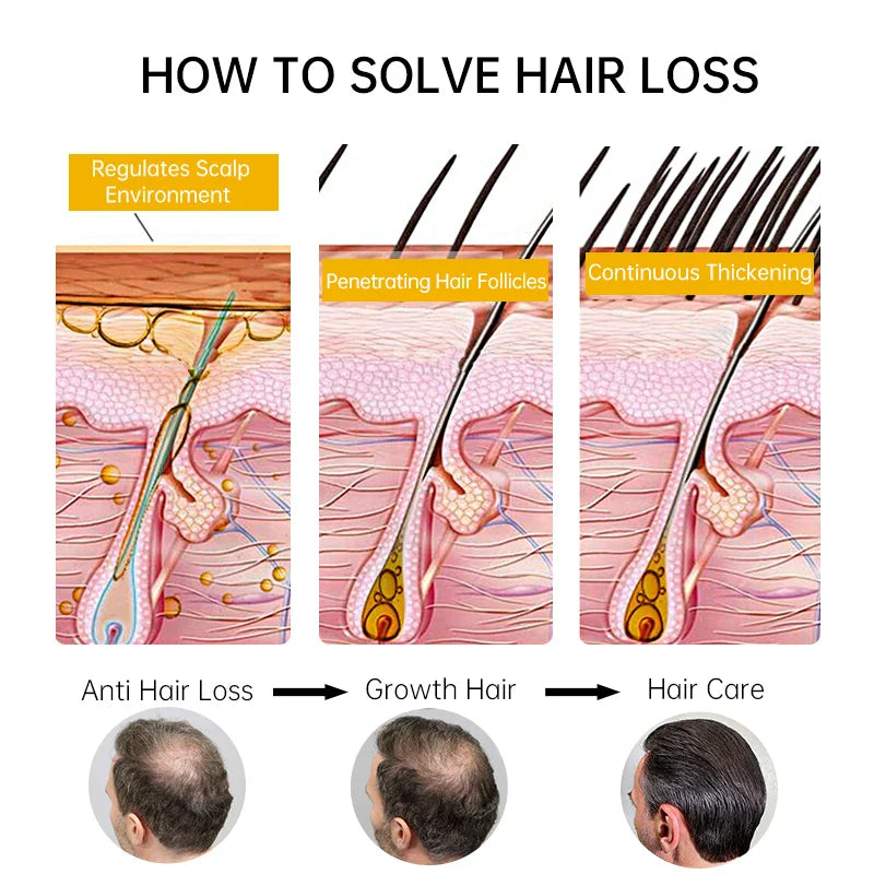 Fast Hair Growth for Men Women Ginger Grow Hair Oil Care Anti Hair Loss Scalp Treatment Serum Products Beauty Health 2023