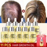 PURC 10PCS Hair Growth for Men Women Products Ginger Hair Oil Fast Grow Serum Anti Loss Regrowth Scalp Treatment Hair Care